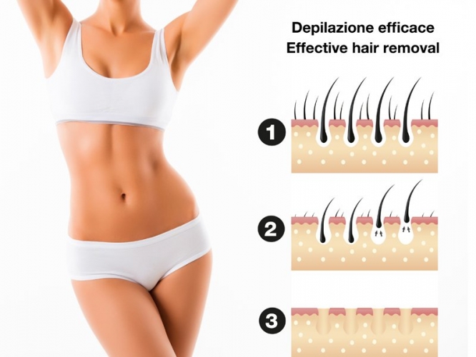 Depiliatorius Beper B3484